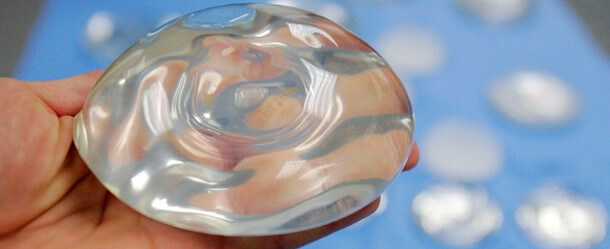 Ripples in breast implants.